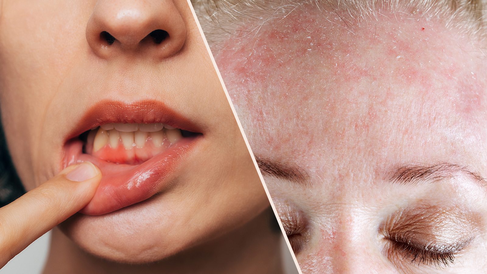 Restorative Yoga Supported Fish Pose Power of Positivity